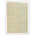 Drops Framed Poster | Agnes Martin Framed Prints Wall Art | Agnes Martin Store